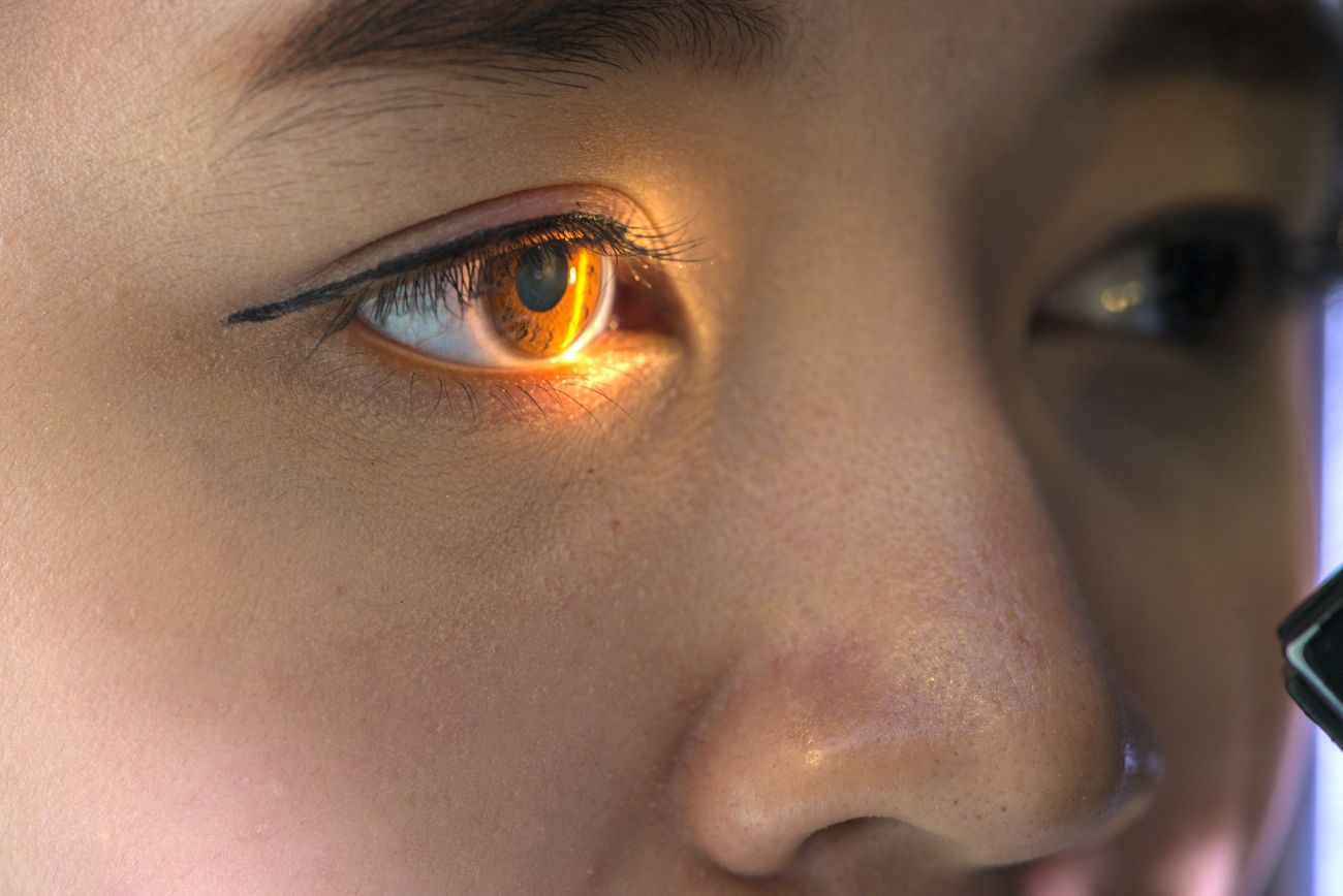 Laser Vision Correction Kaiser